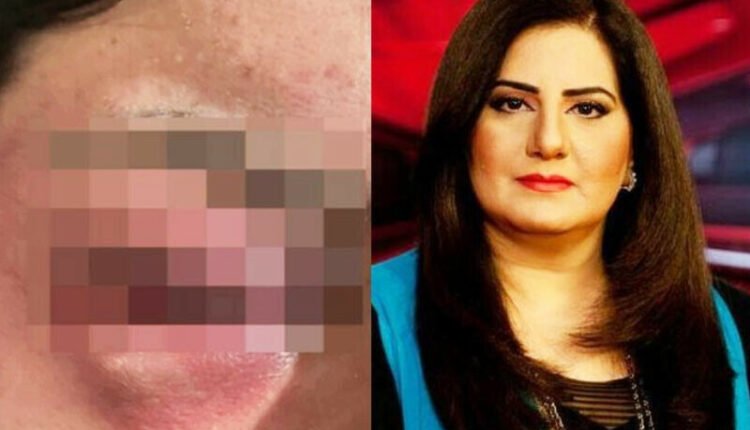 جیسمین منظور کے سابق شوہر پر تشدد کے الزامات، تصاویر شیئر کردیں